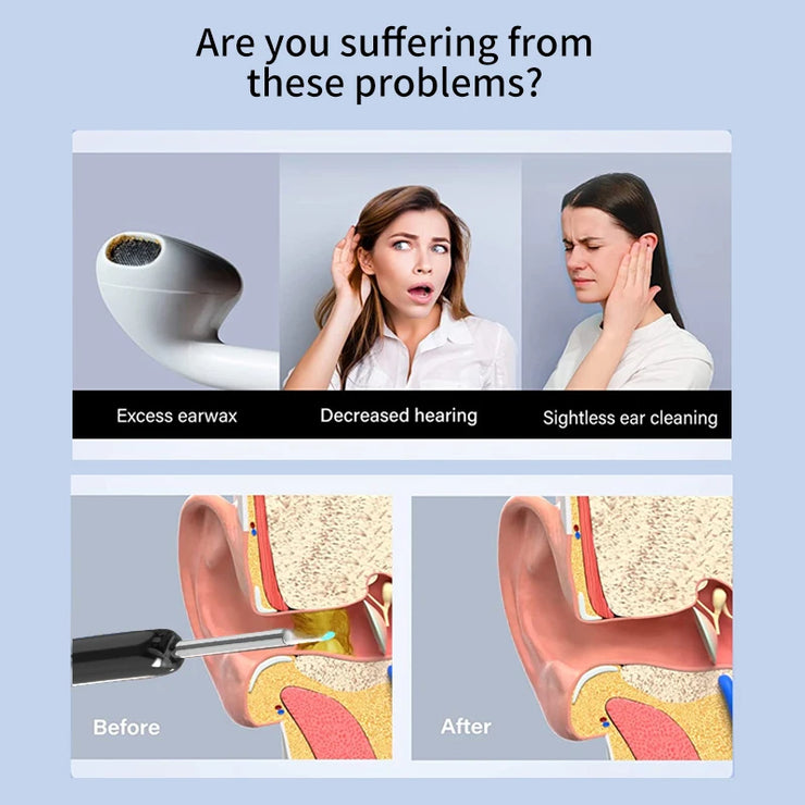 Smart Visual Ear Sticks Otoscope 1296P Ear Cleaner High Precision Ear Wax Removal Tool Mini Camera Health Care Ear Cleaner