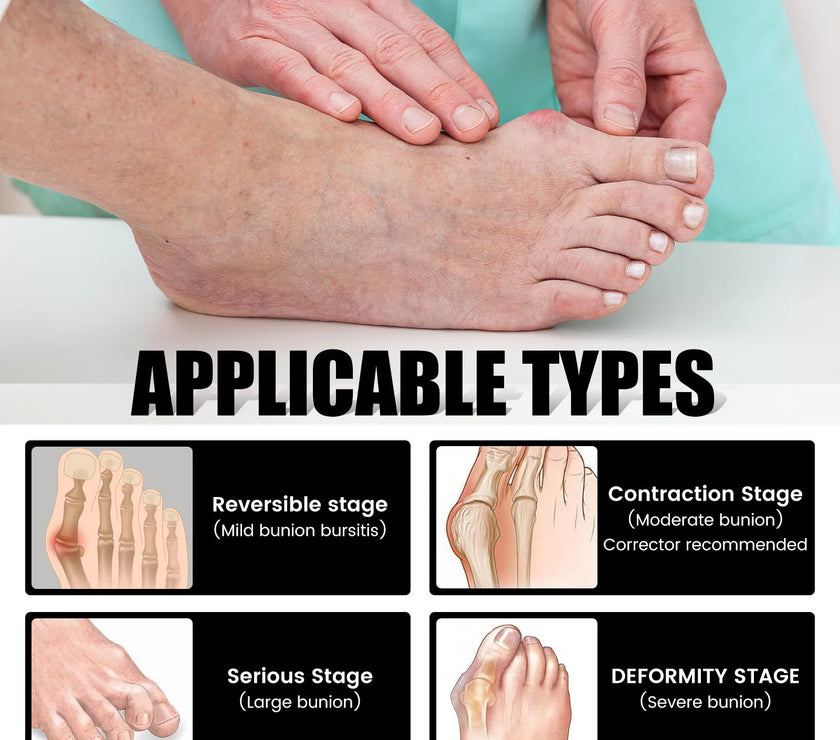 Anti-Bunions Health Sock Pain Stiffness Relief For Outdoor Sports Foot Care Socks Heels Warm Breathable man Meias de Cuidado